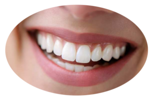 implant supported dentures