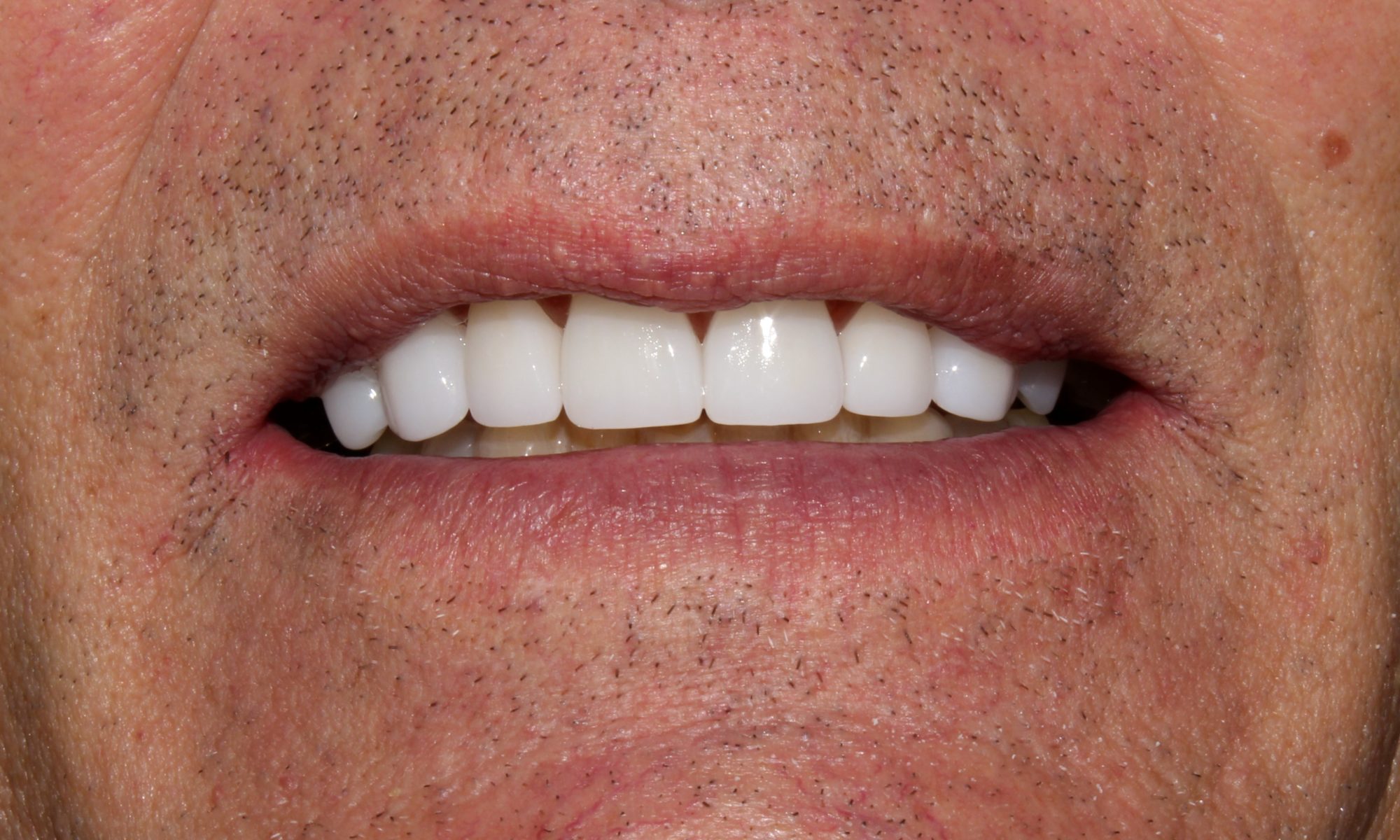 top rated cosmetic dentist near me