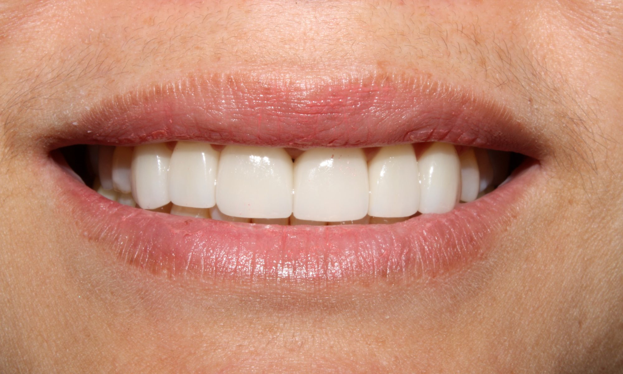 top rated cosmetic dentist near me