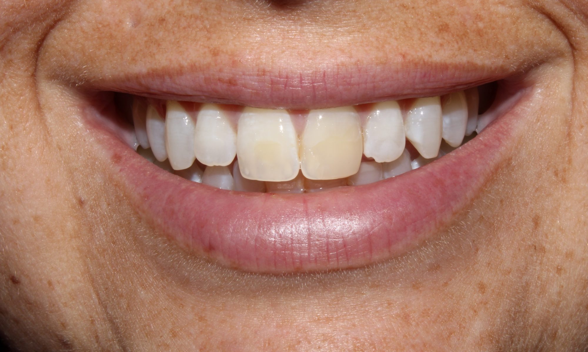cosmetic dentistry cda