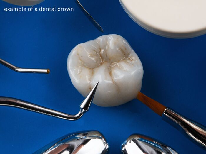 How long do dental crowns last? 1 how often should dental crowns be replaced
Dr. Delwyn Dick (DDS)
Dr. Miranda Anderson (DDS)
Kootenai Dental Group, Coeur d'Alene, ID