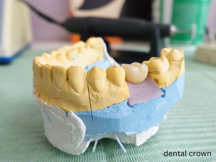 How Much Tooth is Required for a Crown? 1 how bad can a tooth be and still get a crown
Dr. Delwyn Dick (DDS)
Dr. Miranda Anderson (DDS)
Kootenai Dental Group, Coeur d'Alene, ID