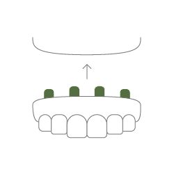KDG Dentures icon