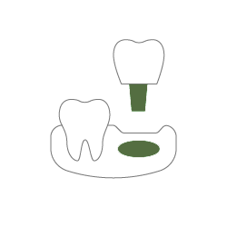 KDG dental implants icon