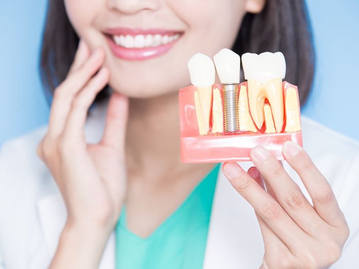 Are Dental Implants Painful? 1 Is it painful to get dental implants
Dr. Delwyn Dick (DDS)
Dr. Miranda Anderson (DDS)
Kootenai Dental Group, Coeur d'Alene, ID