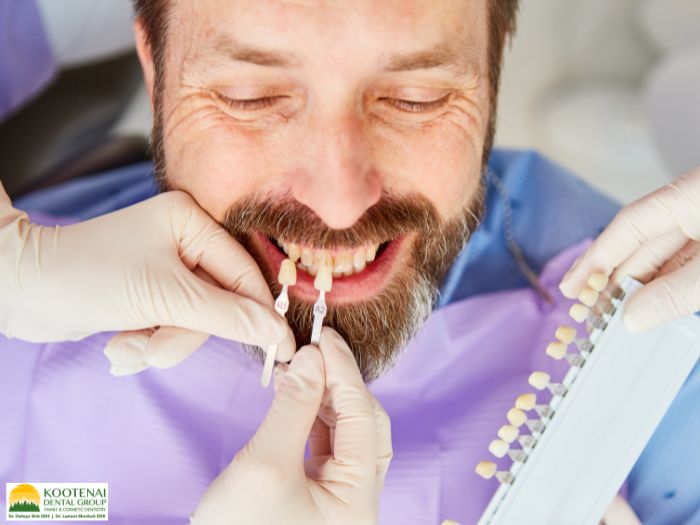 How Do You Know When Veneers Need to be Replaced? 1 How do you know when veneers need to be replaced
Dr. Delwyn Dick (DDS)
Dr. Miranda Anderson (DDS)
Kootenai Dental Group, Coeur d'Alene, ID