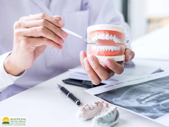 Can Dental Implants Help with Bone Loss? 1 Can Implants Help with Bone Loss
Dr. Delwyn Dick, DDS
Kootenai Dental Group
Coeur d'Alene, ID