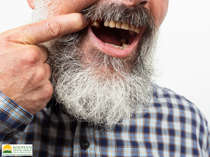 Can Dental Implants Help if My Teeth Have Shifted After Missing a Tooth? 1 Can Dental Implants Help if My Teeth Have Shifted After Missing a Tooth Dr. Delwyn Dick, DDS Kootenai Dental Group Coeur d'Alene, ID
