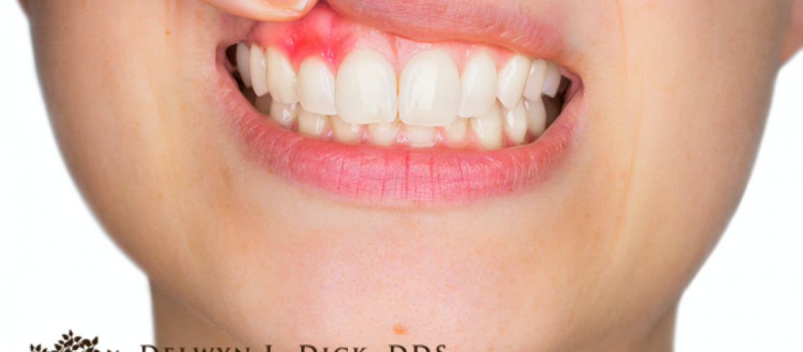 CDA Dentist - heart disease and gum disease